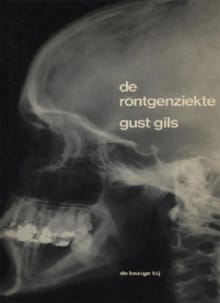 De röntgenziekte - Gust Gils