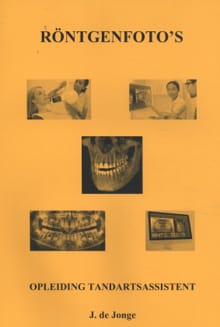 Röntgenfoto's - J. de Jonge