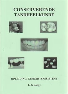 Conserverende Tandheelkunde - J. de Jonge